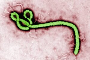 EBOLA TERROR IN CONGO CAMP: 30 Dead As Authorities Fear Silent Mass Infection Among Displaced Families